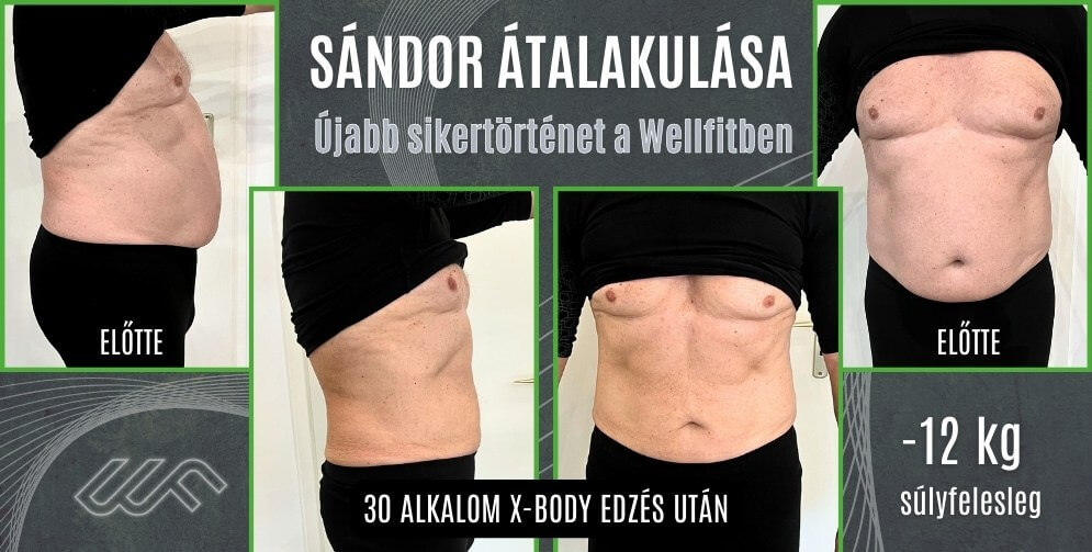 XBody alakformálás Miskolcon A Wellfit Alakformáló Központban