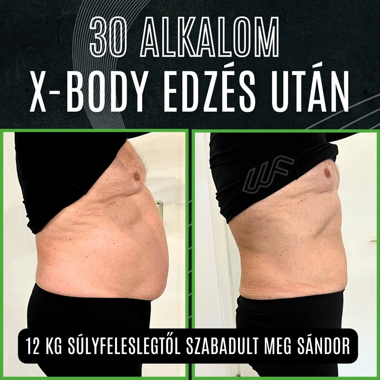 XBody alakformálás Miskolcon A Wellfit Alakformáló Központban