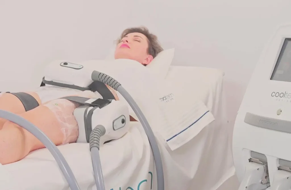 Cooltech Define zsírfagyasztás a WellFit miskolci stúdiójában